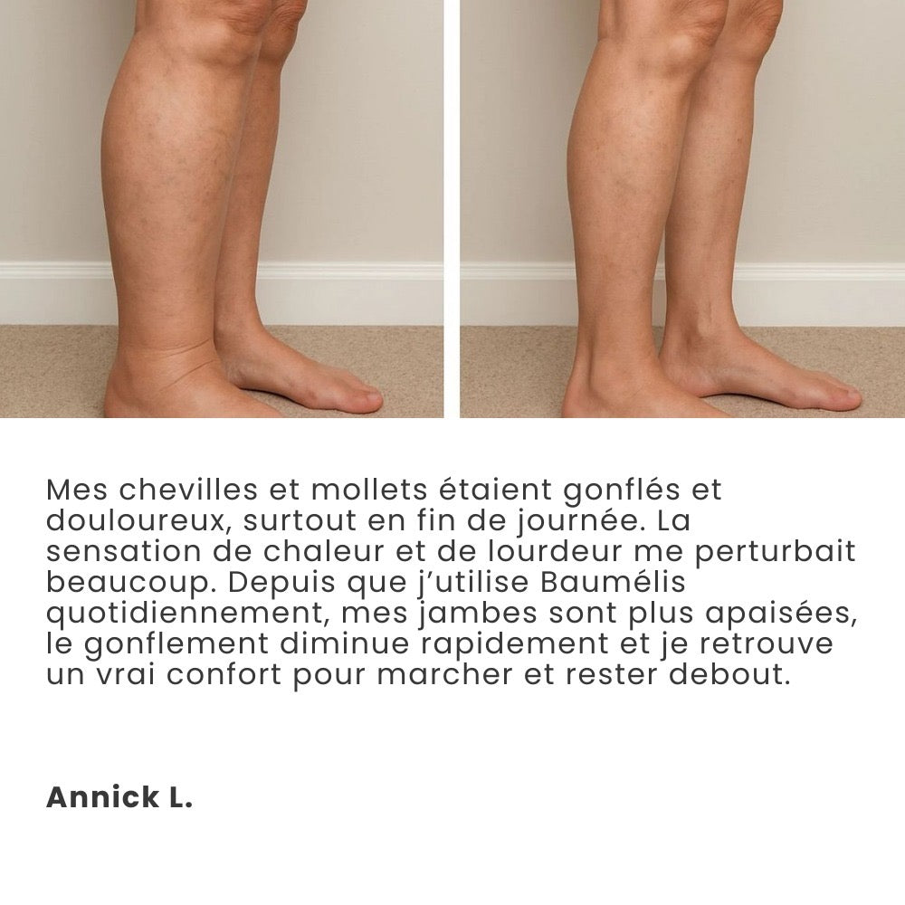 Témoignage cliente Annick L. — photos comparatives des jambes, sensation de confort au quotidien.